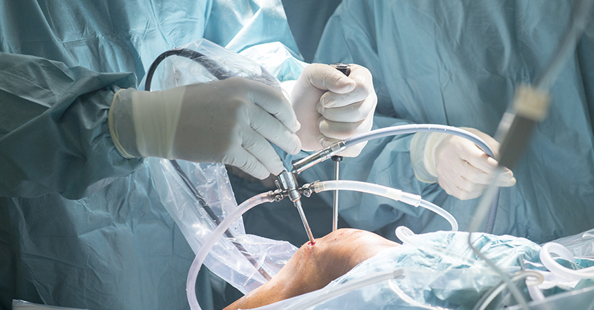 Ορθοπαιδικός Χειρουργός Αντώνιος Κουζέλης-Αρθροσκοπική Αποκατάσταση Πρόσθιου Χιαστού Συνδέσμου